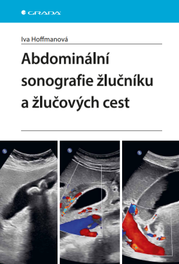 Abdominální sonografie žlučníku a žlučových cest - Iva Hoffmanová