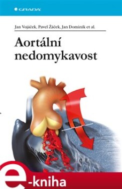 Aortální nedomykavost - Jan Vojáček, Pavel Žáček, Jan Dominik e-kniha