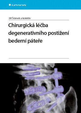 Chirurgická léčba degenerativního postižení bederní páteře Jiří Šrámek