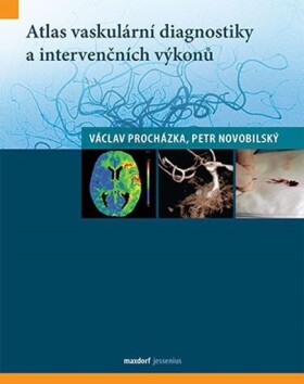 Atlas vaskulární diagnostiky intervenčních výkonů
