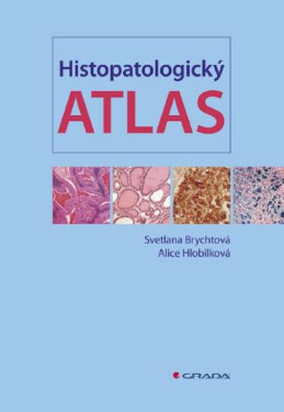 Histopatologický atlas - Svetlana Brychtová, Alice Hlobilková