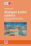 Maligní kožní nádory | Ivana Krajsová