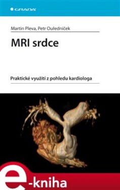 MRI srdce. Praktické využití z pohledu kardiologa - Martin Pleva, Petr Ouředníček e-kniha