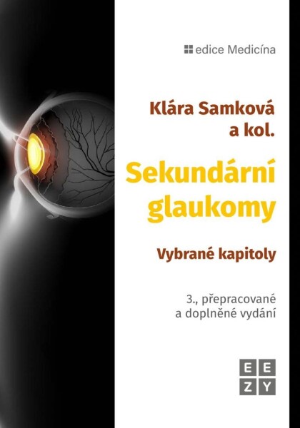 Sekundární glaukomy