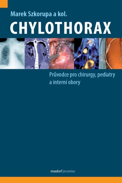 Chylothorax