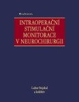 Intraoperační stimulační monitorace v neurochirurgii - Lubor Stejskal - e-kniha