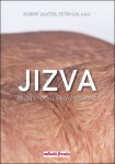 Jizva nejen popáleninové medicíně