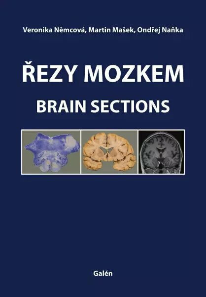 Řezy mozkem / Brain Sections - Ondřej Naňka, Martin Mašek, Veronika Němcová