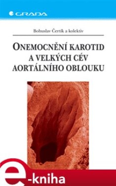 Onemocnění karotid a velkých cév aortálního oblouku - Bohuslav Čertík e-kniha