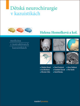 Dětská neurochirurgie kazuistikách