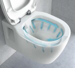 REA - Závěsná WC mísa Carter se sedátkem SLIM, rimless, bílá REA-C1400