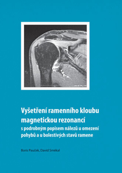 Vyšetření ramenního kloubu magnetickou rezonancí s podrobným popisem nálezů u omezení pohybů u bolestivých stavů ramene - Boris Pauček, David Smékal