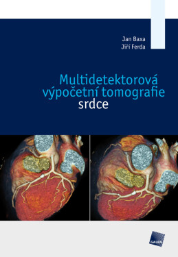 Multidetektorová výpočetní tomografie srdce - Jiří Ferda, Jan Baxa