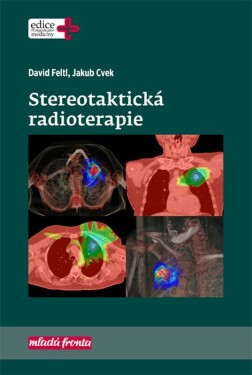 Stereotaktická radioterapie Jakub Cvek