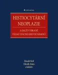 Histiocytární neoplazie další vybrané vzácné krevní nemoci