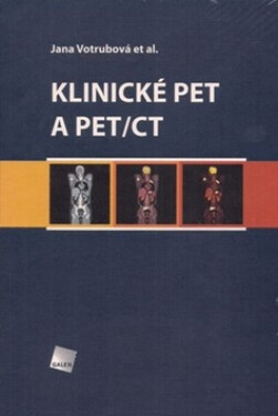 Klinické PET a PET/CT - Jana Votrubová