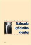 Náhrada kyčelního kloubu - Antonín Sosna