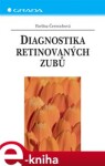 Diagnostika retinovaných zubů - Pavlína Černochová e-kniha