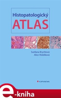 Histopatologický atlas - Svetlana Brychtová, Alice Hlobilková e-kniha