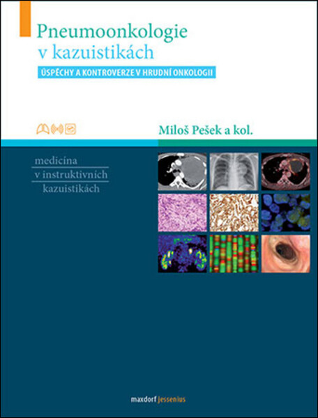 Pneumoonkologie kazuistikách