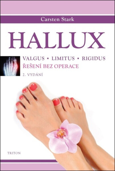 Hallux - Řešení bez operace, 2. vydání - Carsten Stark