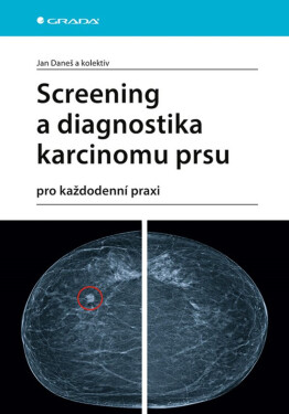 Screening a diagnostika karcinomu prsu - kolektiv autorů, Jan Daneš