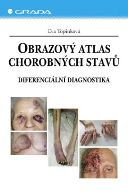 Obrazový atlas chorobných stavů - Eva Topinková