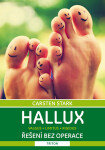 Hallux