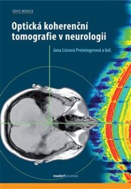 Optická koherenční tomografie neurologii