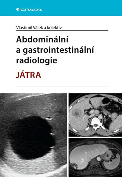 Abdominální a gastrointestinální radiologie - Vlastimil Válek, kolektiv autorů