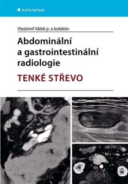 Abdominální a gastrointestinální radiologie - tenké střevo