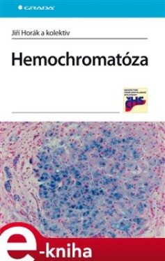 Hemochromatóza - Jiří Horák e-kniha