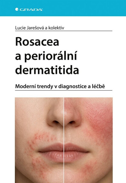 Rosacea a periorální dermatitida - Lucie Jarešová