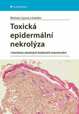 Toxická epidermální nekrolýza - Břetislav Lipový