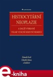 Histiocytární neoplazie a další vybrané velmi vzácné krevní nemoci - Zdeněk Adam, Zdeněk Král, kolektiv e-kniha