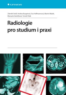 Radiologie pro studium i praxi - Zdeněk Seidl, Manuela Vaněčková, Andrea Burgetová, Eva Hoffmannová, Martin Mašek, Tomáš Viták - e-kniha