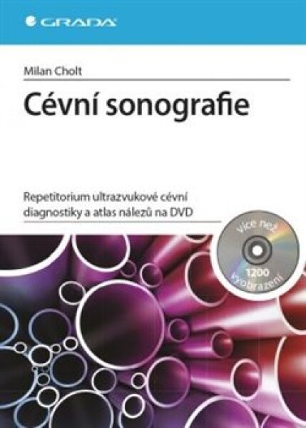 Cévní sonografie Milan Cholt