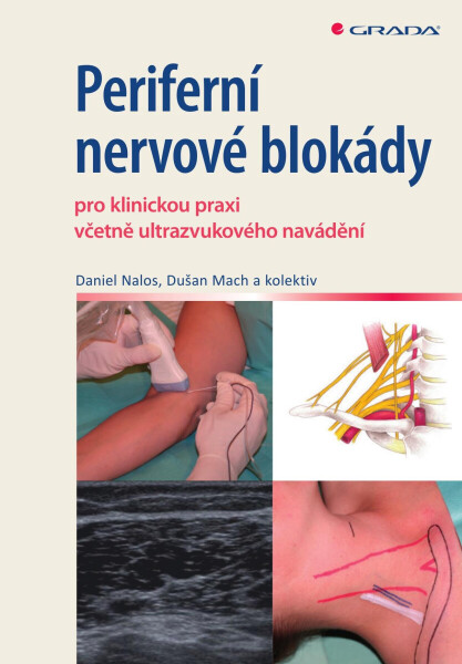 Periferní nervové blokády - Daniel Nalos, Dušan Mach
