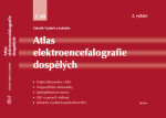 Atlas elektroencefalografie dospělých díl Zdeněk Vojtěch