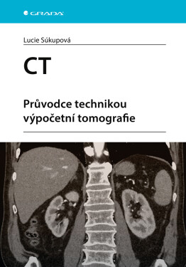 CT