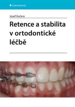 Retence a stabilita v ortodontické léčbě - Josef Kučera - e-kniha