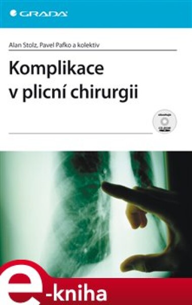 Komplikace v plicní chirurgii - Alan Stolz, Pavel Pafko