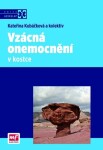 Vzácná onemocnění v kostce | Kateřina Kubáčková