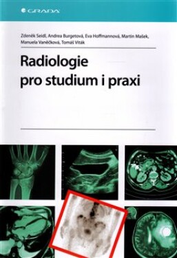 Radiologie pro studium praxi Zdeněk Seidl, Andrea Burgetová, Eva Hoffmannová, Martin Mašek, Manuela Vaněčková, Tomáš Viták