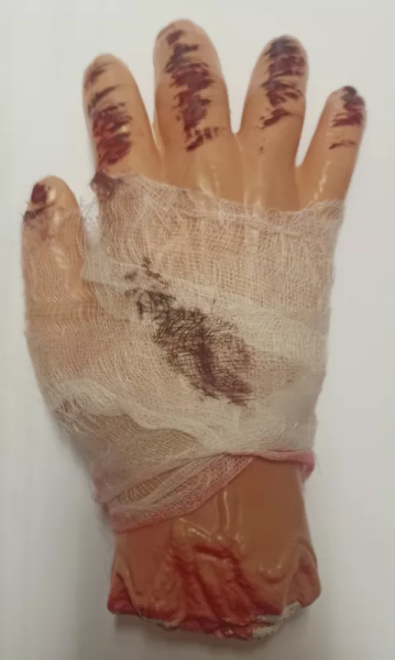 Ptakoviny.cz Ruka s obvazem