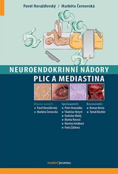 Neuroendokrinní nádory plic mediastina