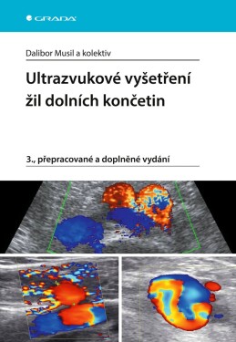 Ultrazvukové vyšetření žil dolních končetin - Dalibor Musil