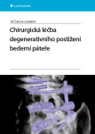 Chirurgická léčba degenerativního postižení bederní páteře Jiří Šrámek