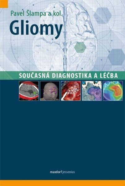 Gliomy Současná diagnostika léčba,