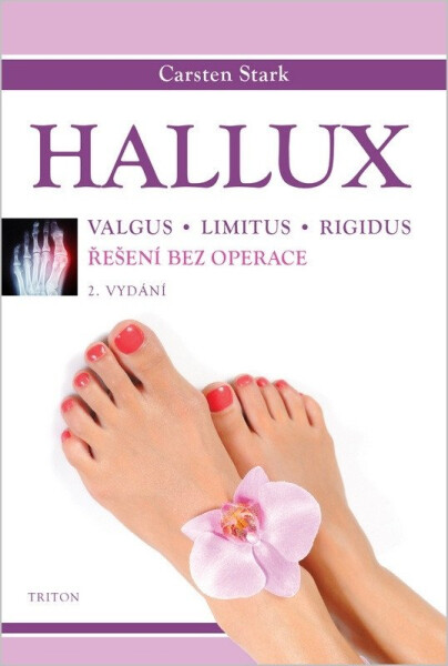 Hallux - Řešení bez operace - Carsten Stark